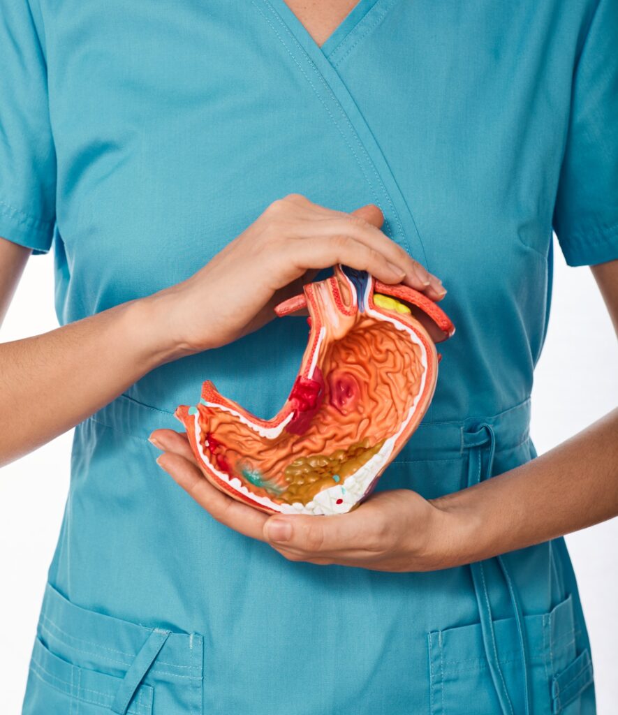 Diagnosis and treatment of stomach disease. Doctor holding anatomical model of stomach with
