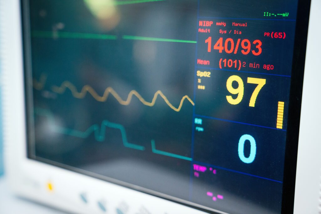 Ekg machine in hospital emergency room used for heart attack diagnosis